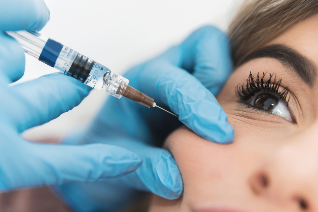 Cheek filler image
